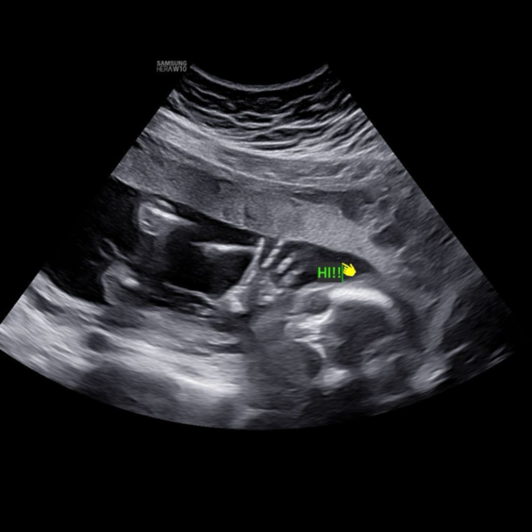 Photo shared by Ashley for their Babylist baby registry.