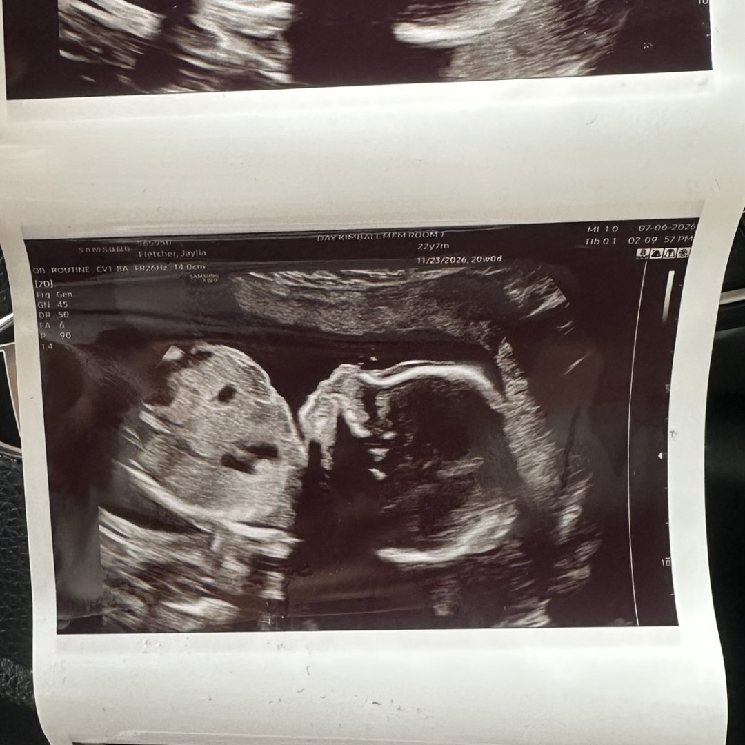 Photo shared by Jaylia for their Babylist baby registry.