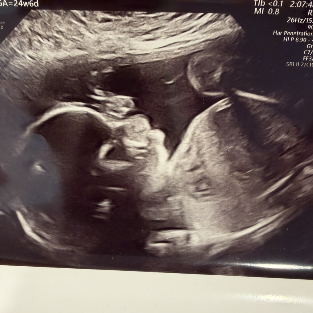 Photo shared by Hannah for their Babylist baby registry.