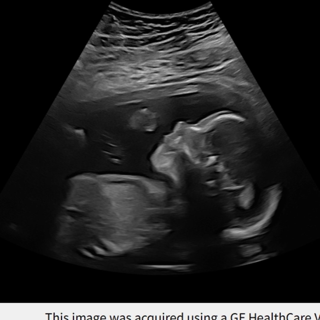 Photo shared by Amanda for their Babylist baby registry.