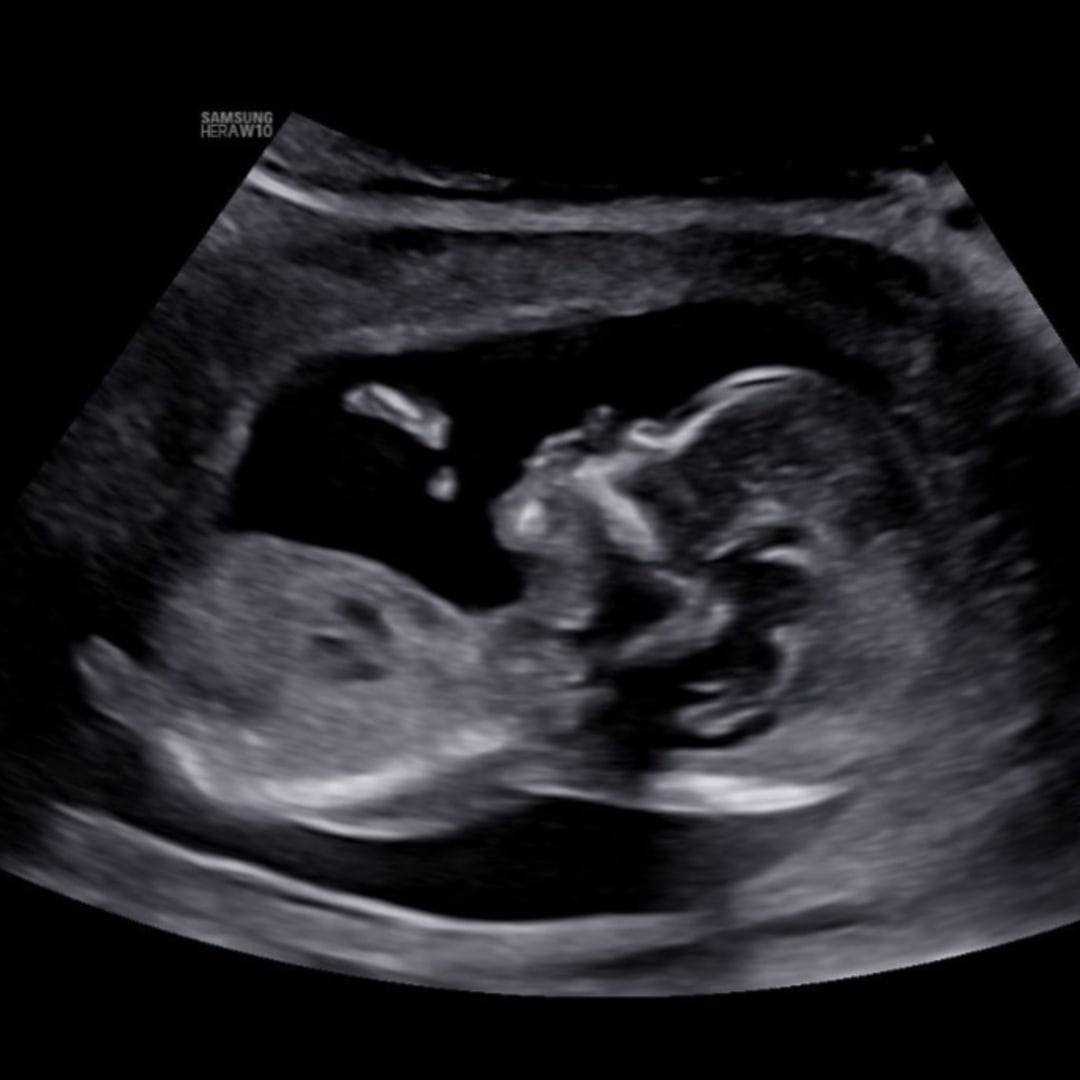 Photo shared by Jekyra for their Babylist baby registry.
