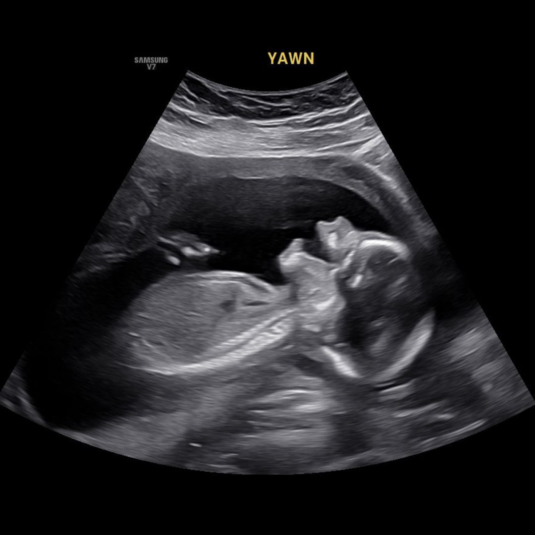 Photo shared by Breanna for their Babylist baby registry.