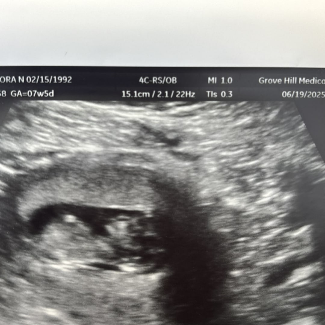 Photo shared by Cora for their Babylist baby registry.