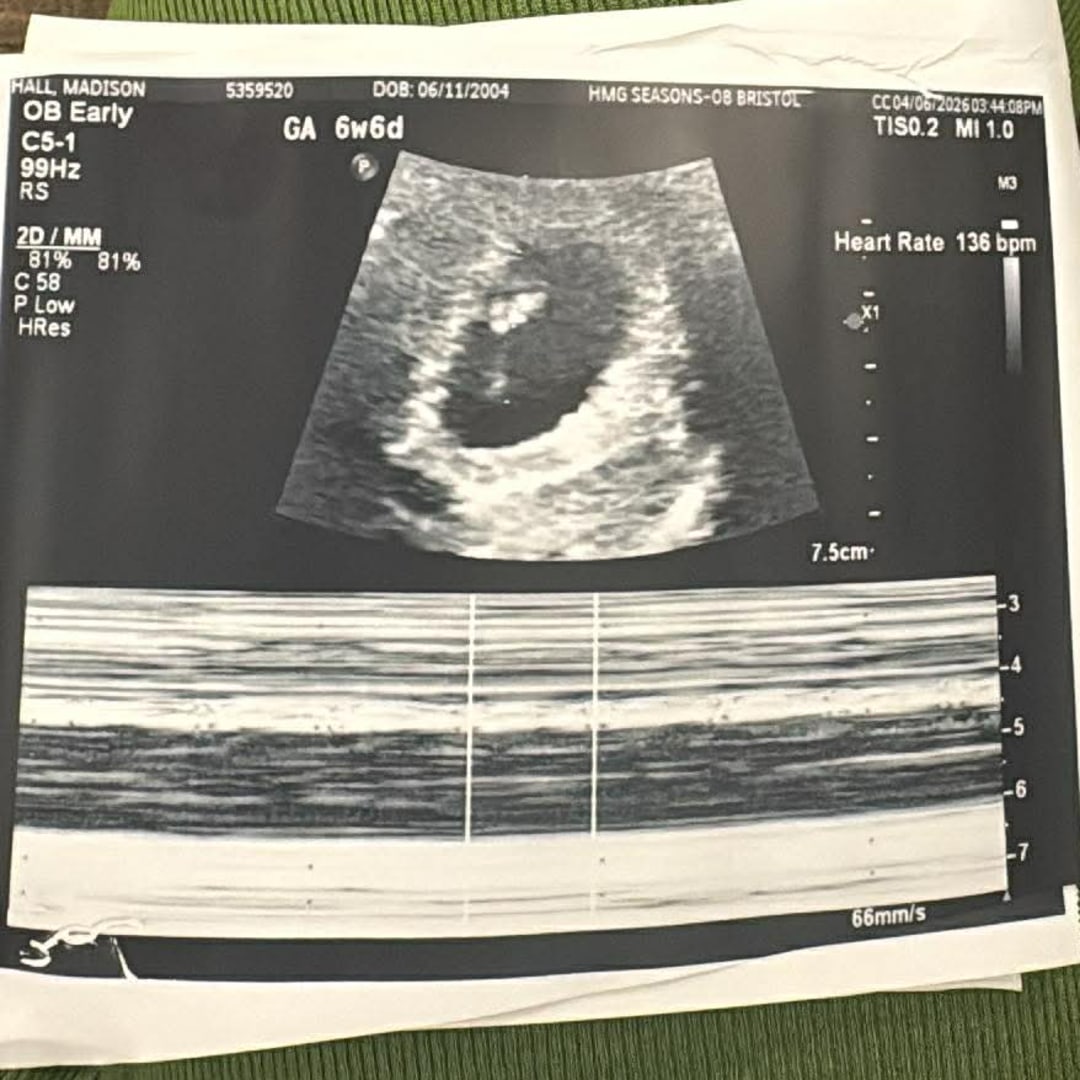 Photo shared by Madison for their Babylist baby registry.