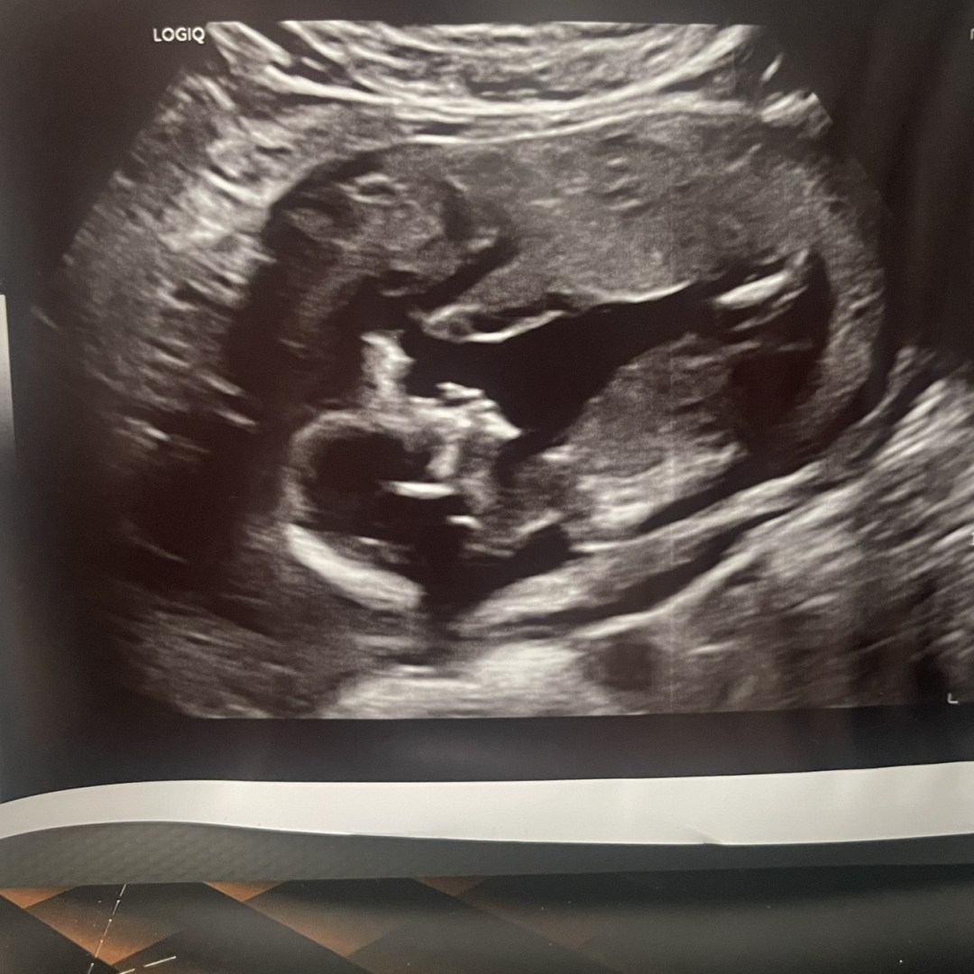 Photo shared by Jordan for their Babylist baby registry.