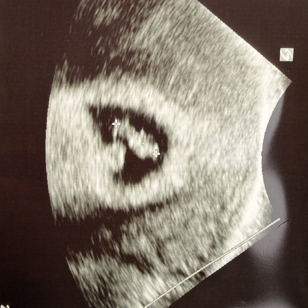 Photo shared by Brianne for their Babylist baby registry.