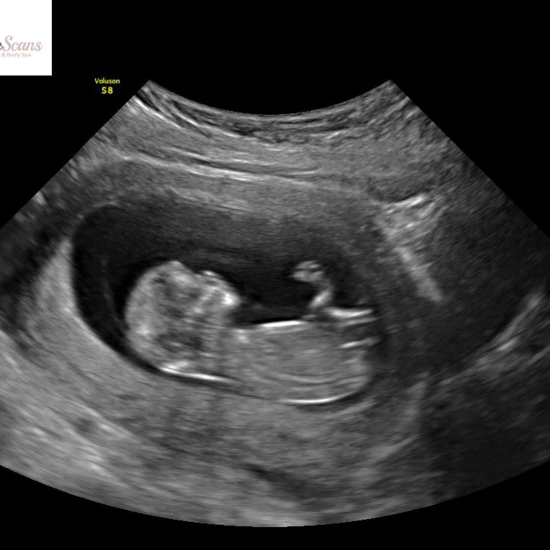 Photo shared by Avery for their Babylist baby registry.