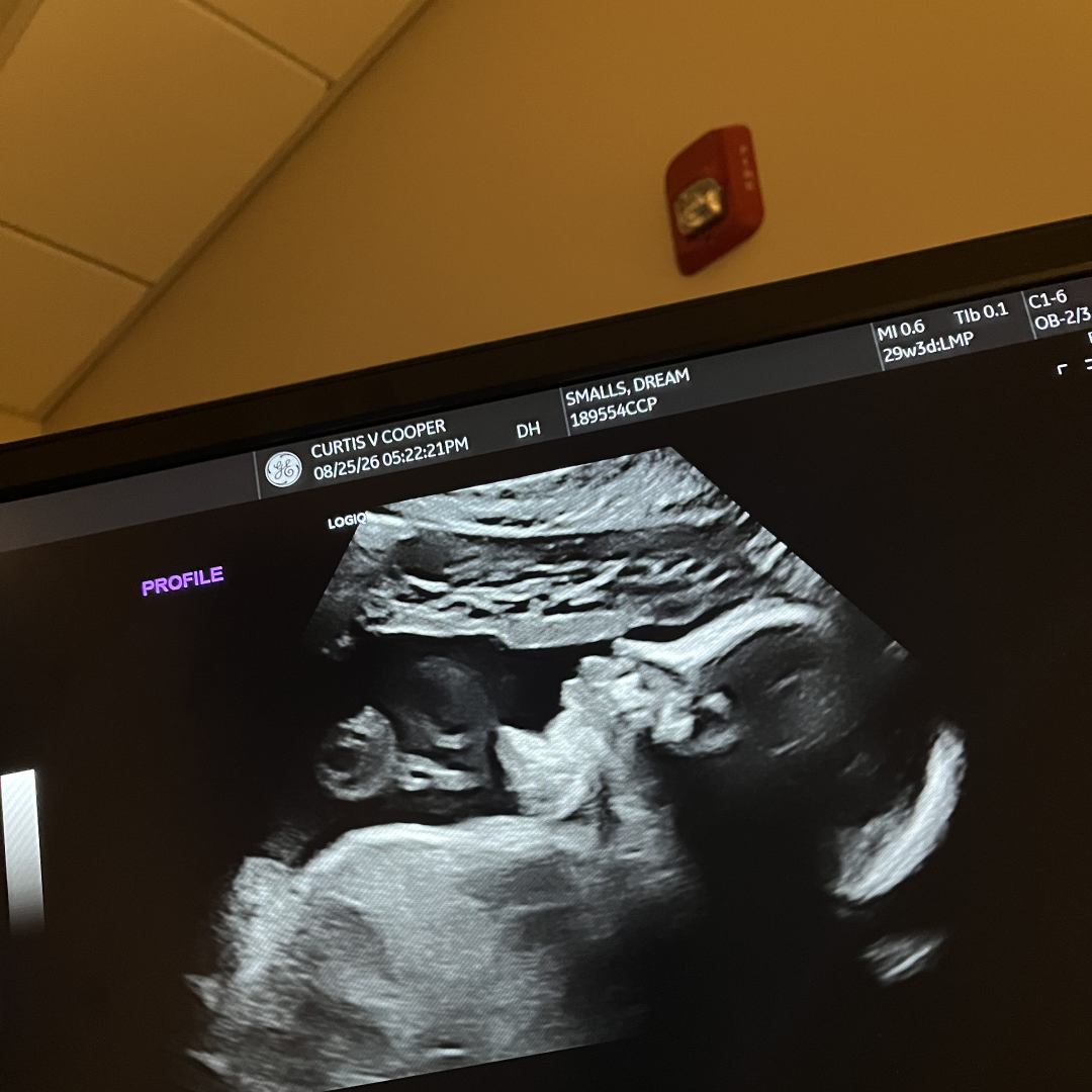 Photo shared by Dream for their Babylist baby registry.
