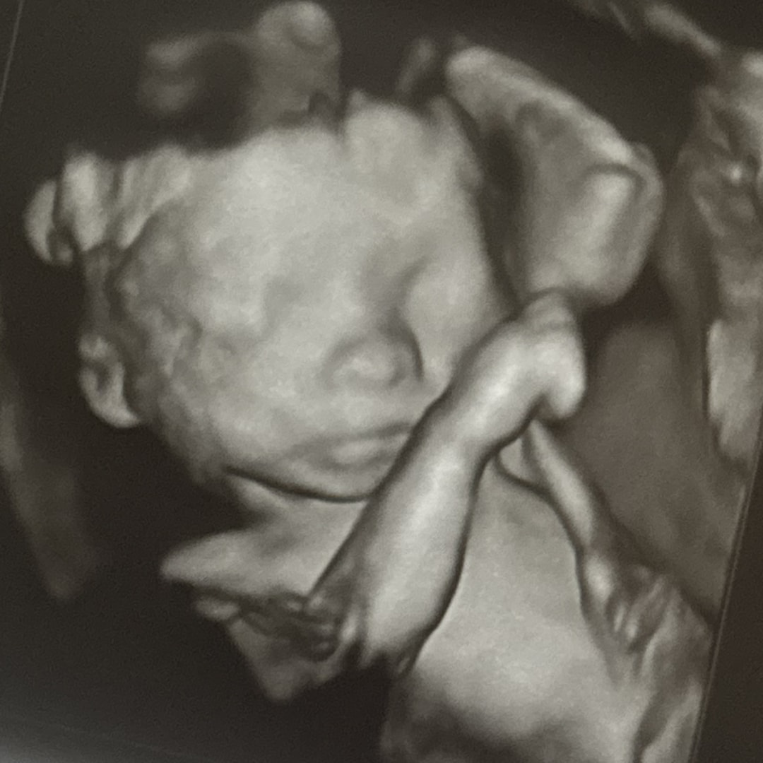 Photo shared by Michelle for their Babylist baby registry.