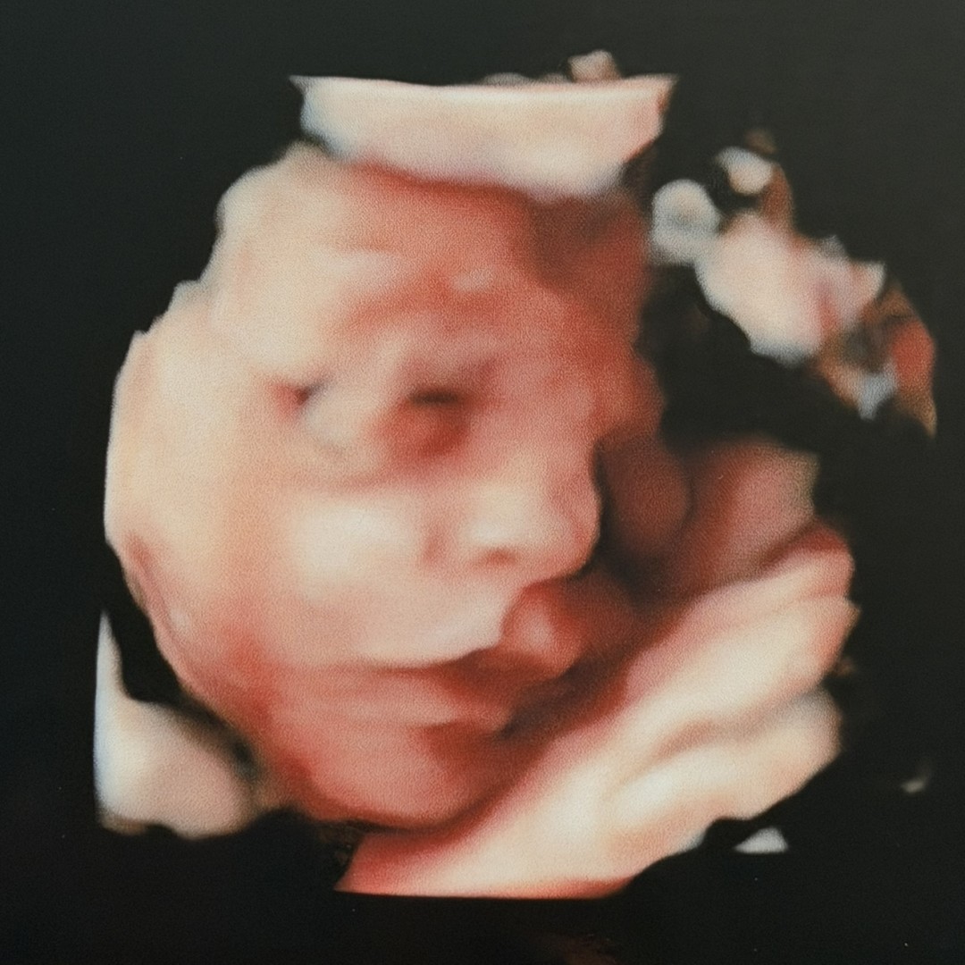 Photo shared by Catalina for their Babylist baby registry.
