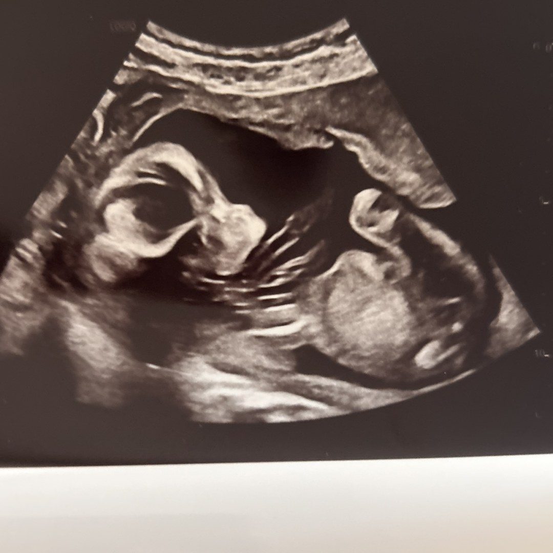 Photo shared by Kayla for their Babylist baby registry.