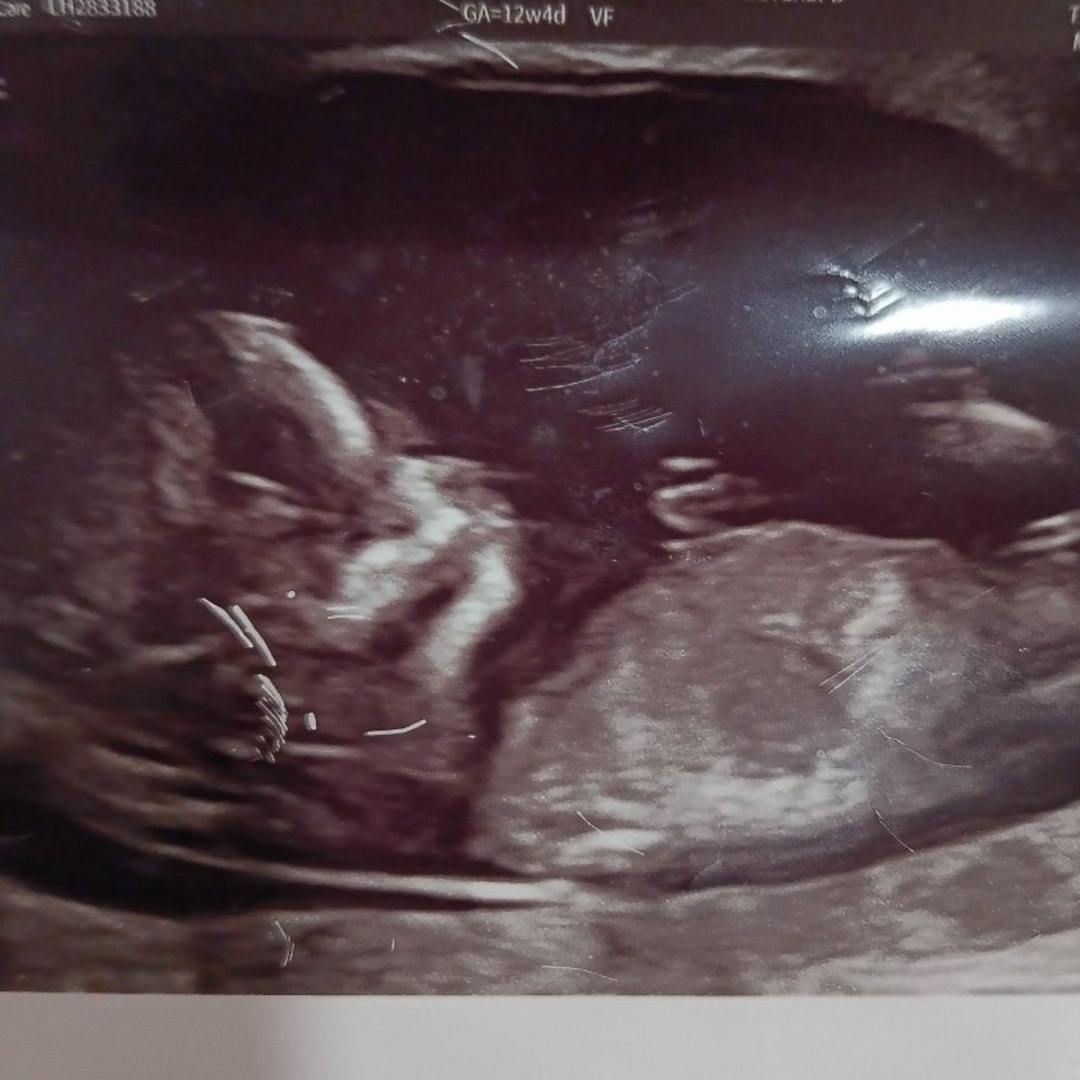 Photo shared by Jaylei for their Babylist baby registry.
