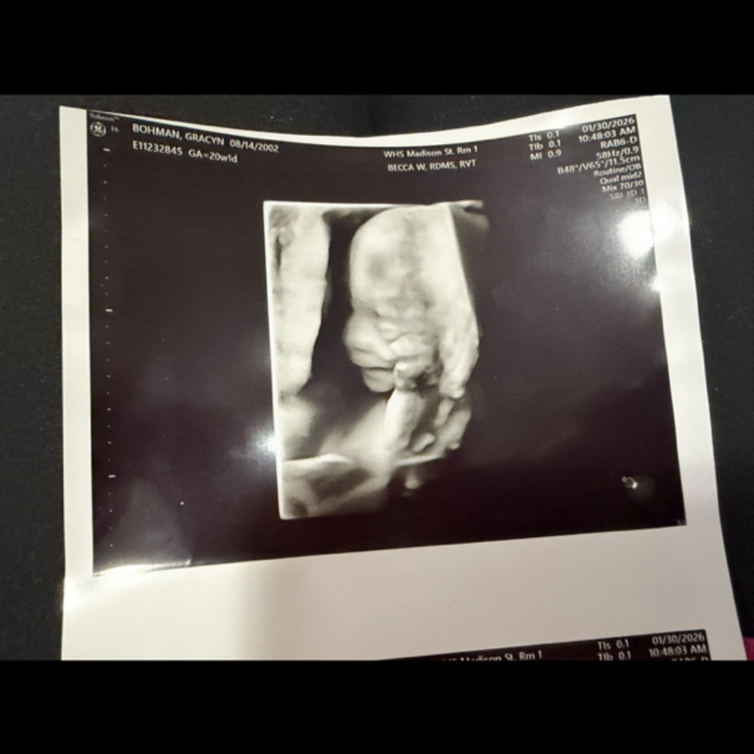 Photo shared by Grace for their Babylist baby registry.