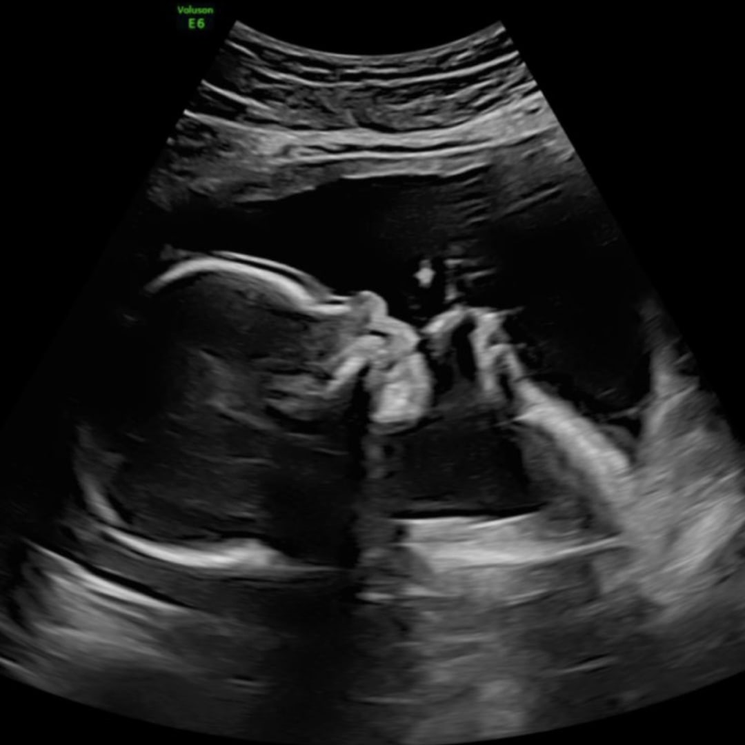 Photo shared by Amanda for their Babylist baby registry.