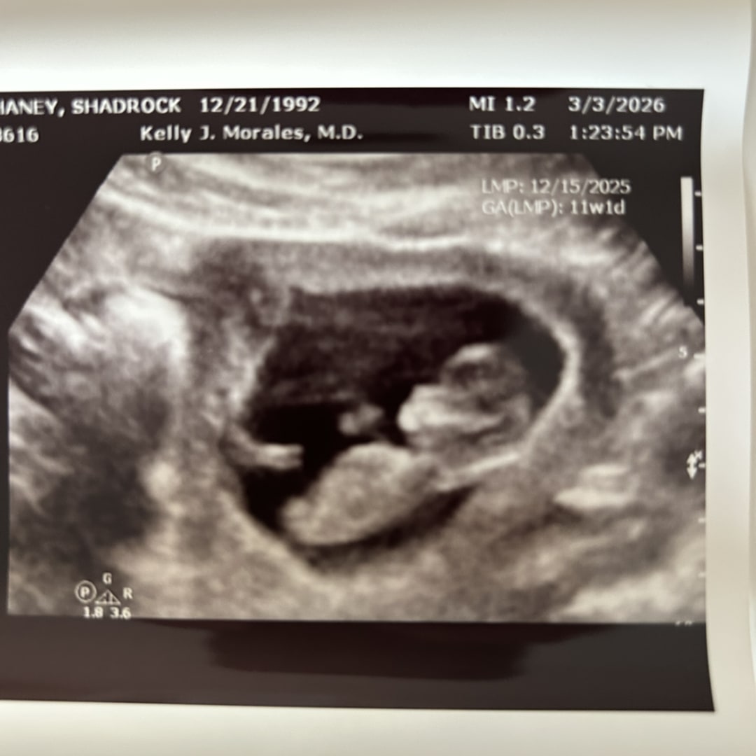 Photo shared by Chaney for their Babylist baby registry.