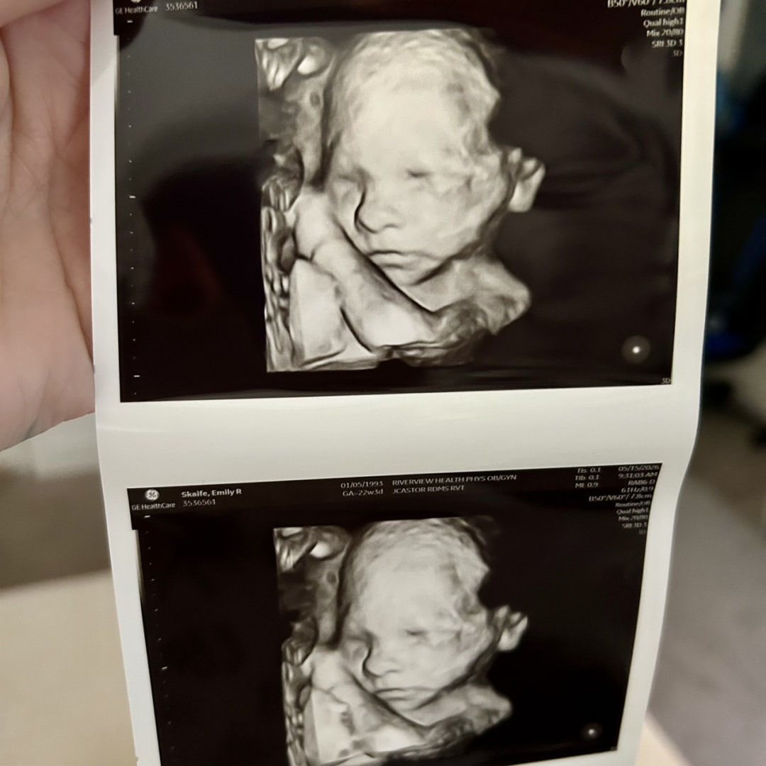Photo shared by Emily for their Babylist baby registry.