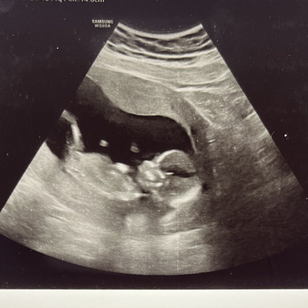 Photo shared by Yeimi for their Babylist baby registry.