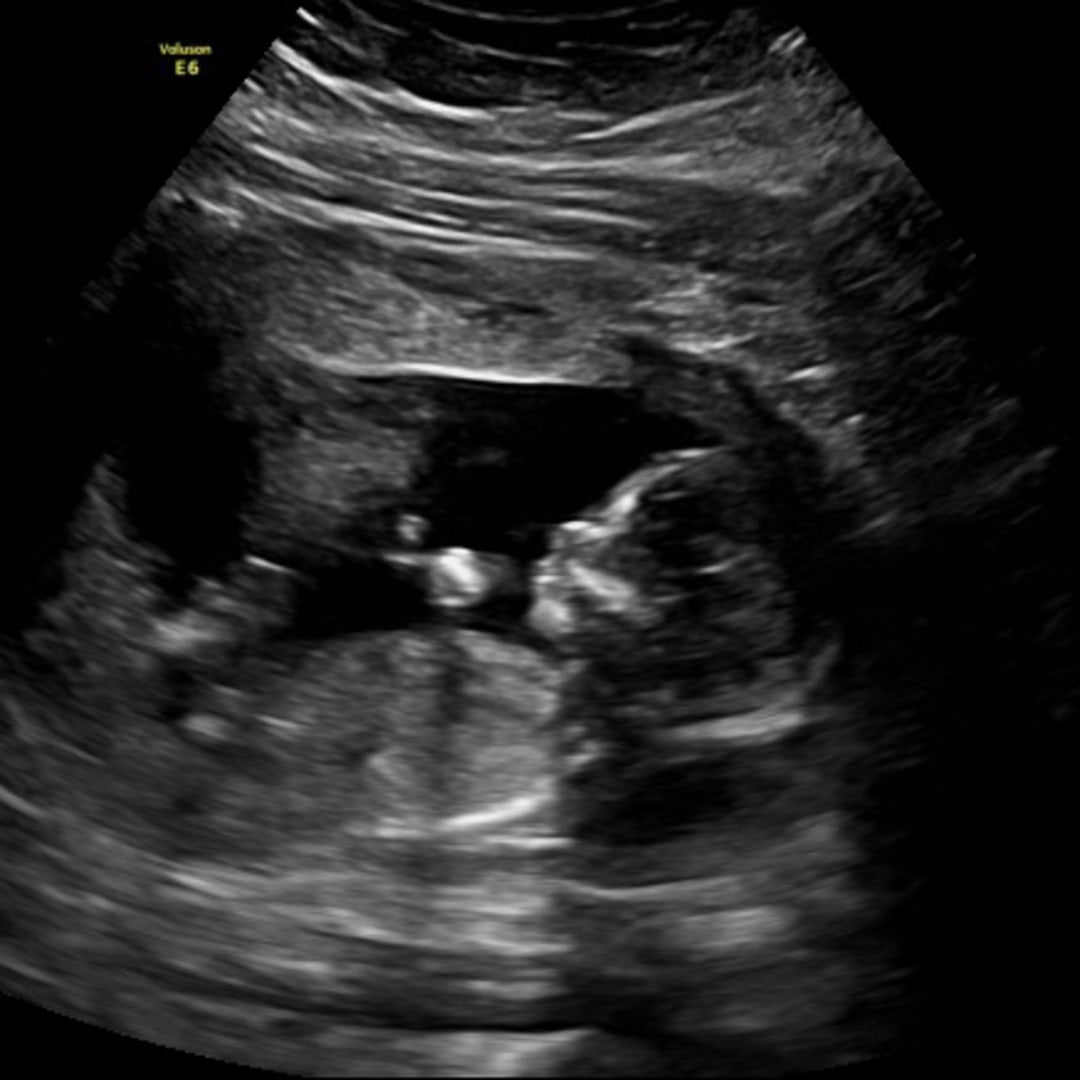Photo shared by Daymis for their Babylist baby registry.