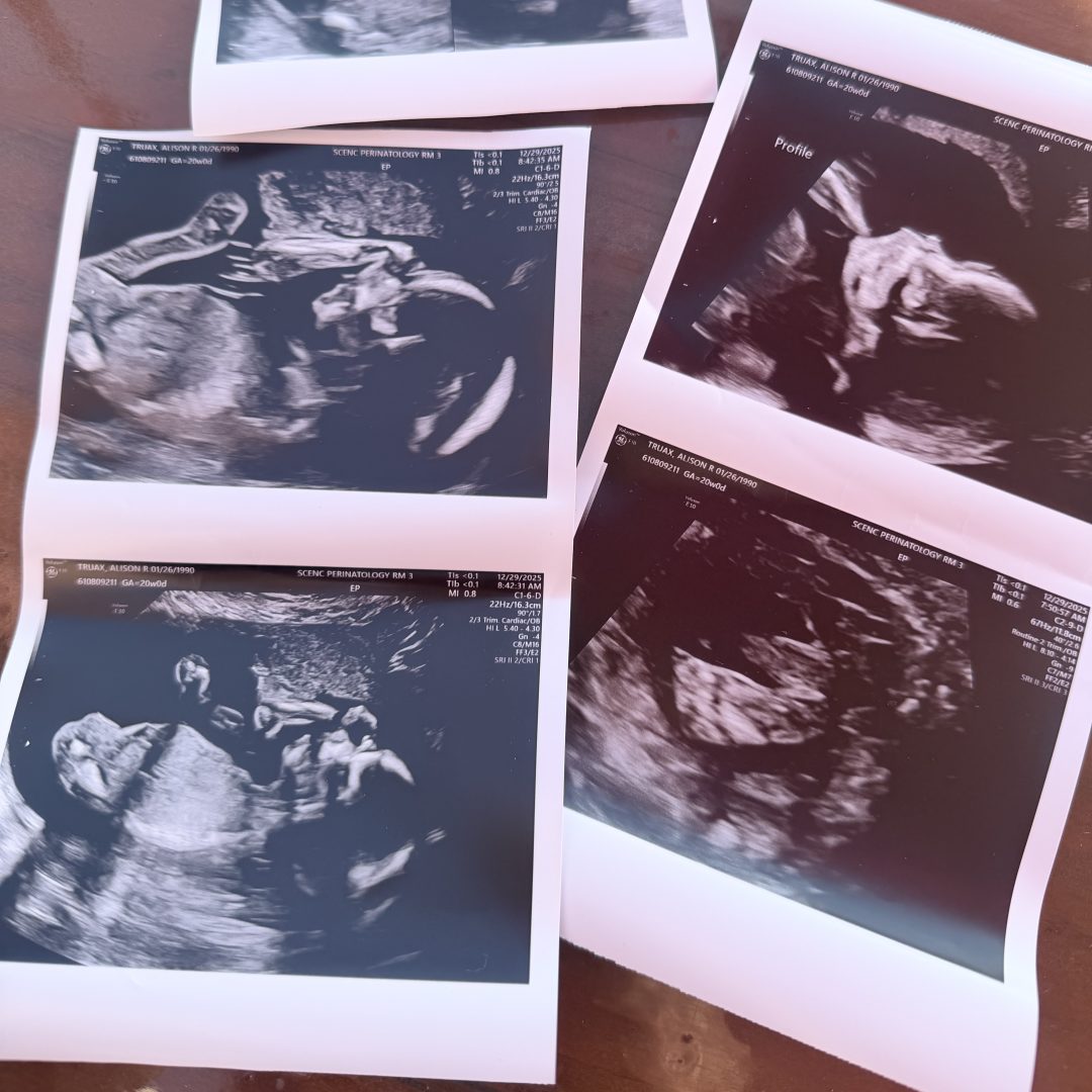 Photo shared by Alison for their Babylist baby registry.