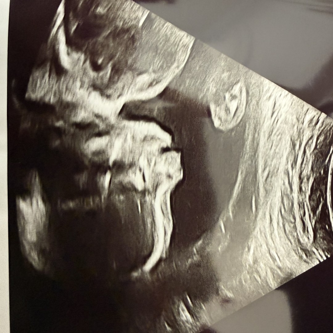 Photo shared by Caitlyn for their Babylist baby registry.