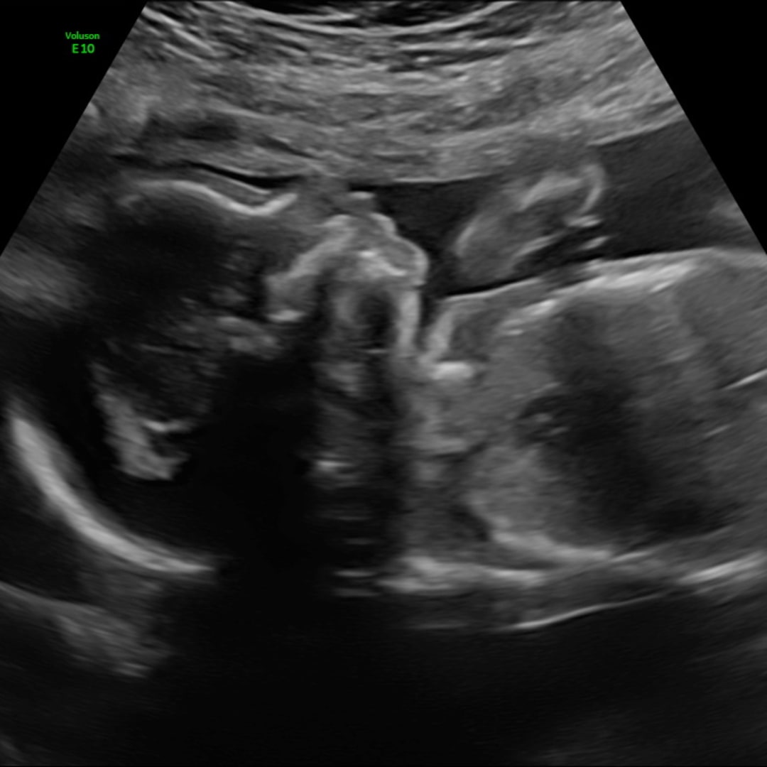 Photo shared by Nancy for their Babylist baby registry.