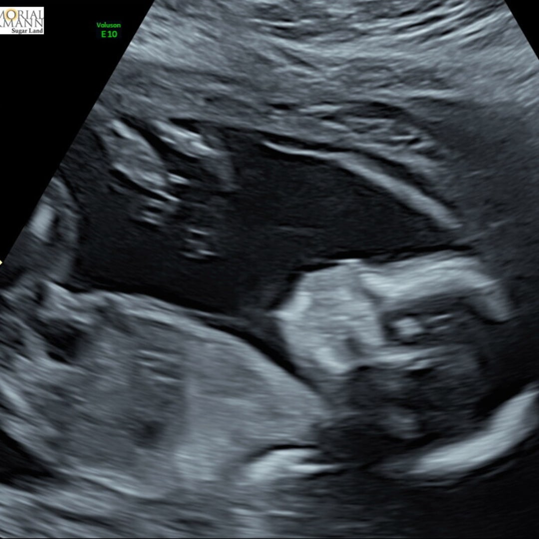 Photo shared by Brenda for their Babylist baby registry.