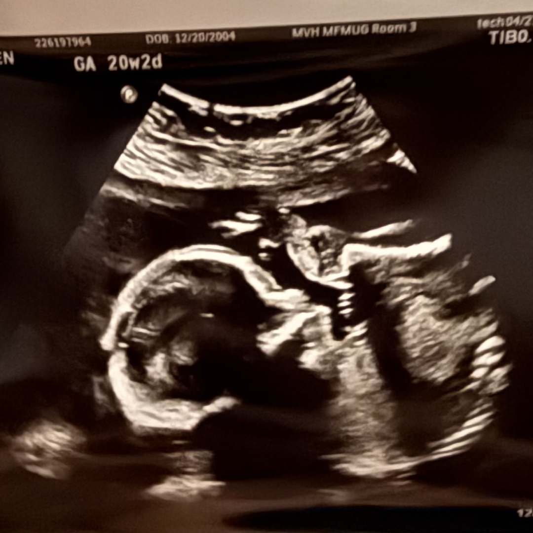 Photo shared by Rachel for their Babylist baby registry.