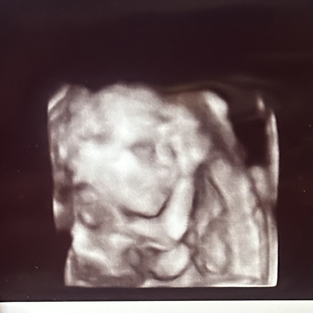 Photo shared by Denise for their Babylist baby registry.