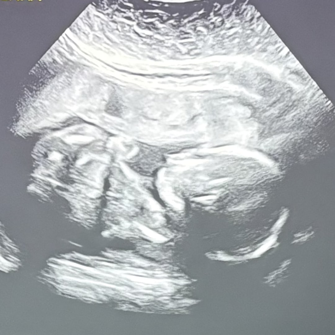 Photo shared by Emycelin for their Babylist baby registry.