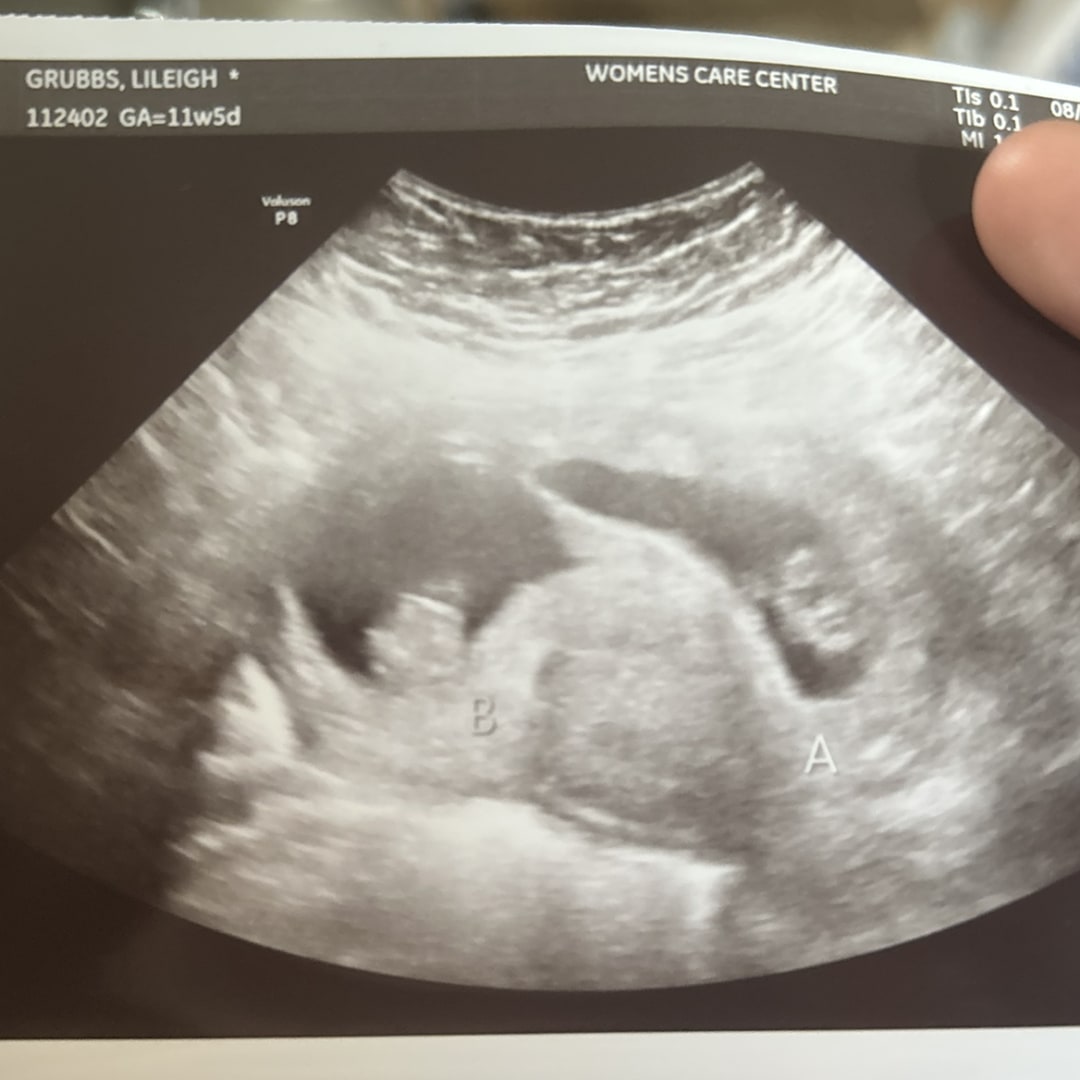 Photo shared by Lileigh for their Babylist baby registry.