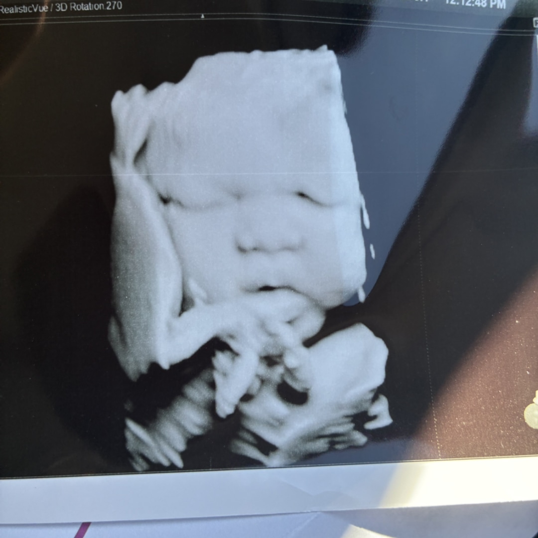 Photo shared by Lauren for their Babylist baby registry.