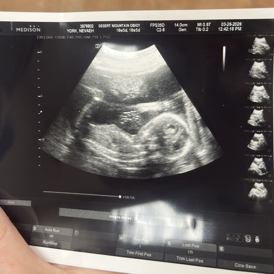 Photo shared by Nevaeh for their Babylist baby registry.