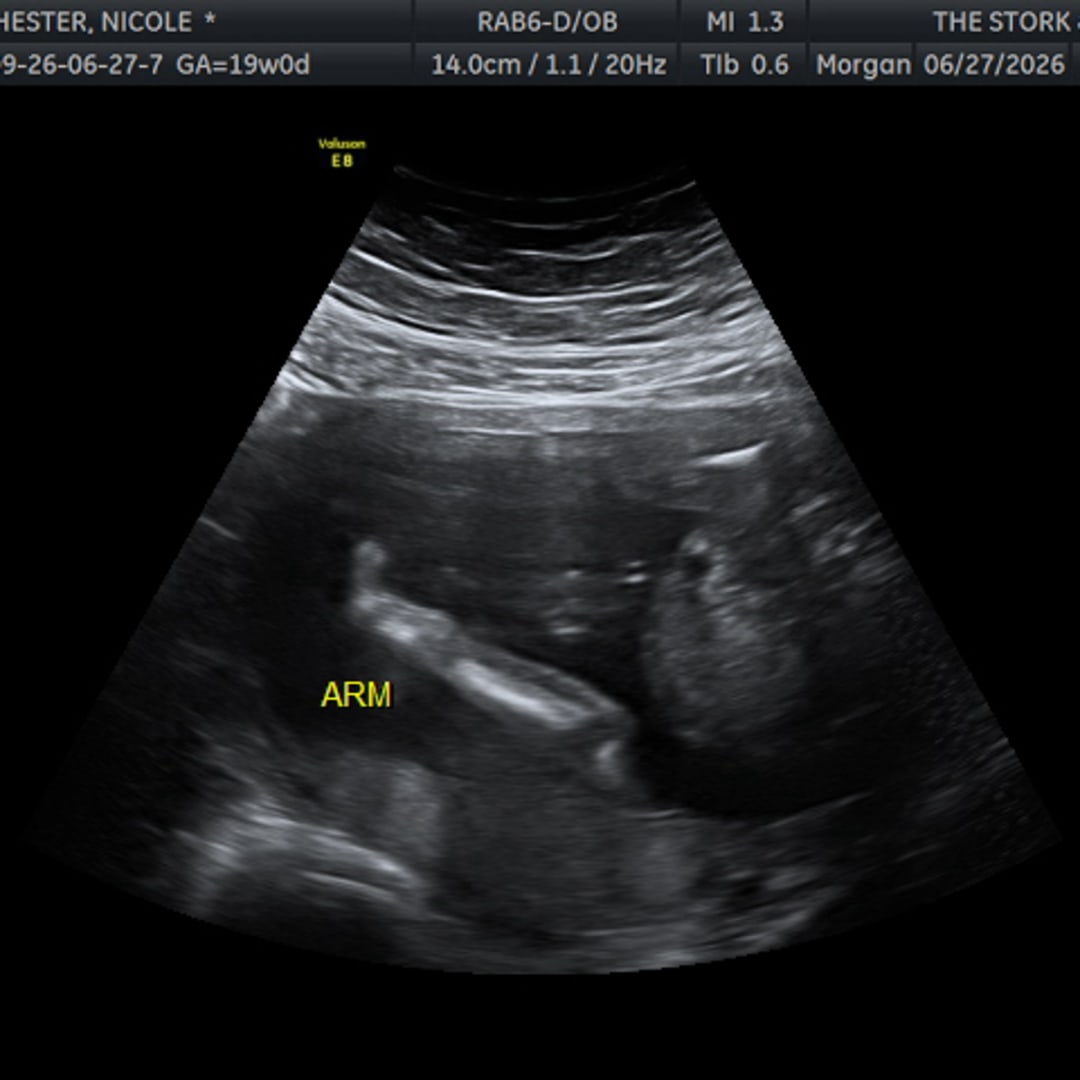 Photo shared by Nicole for their Babylist baby registry.
