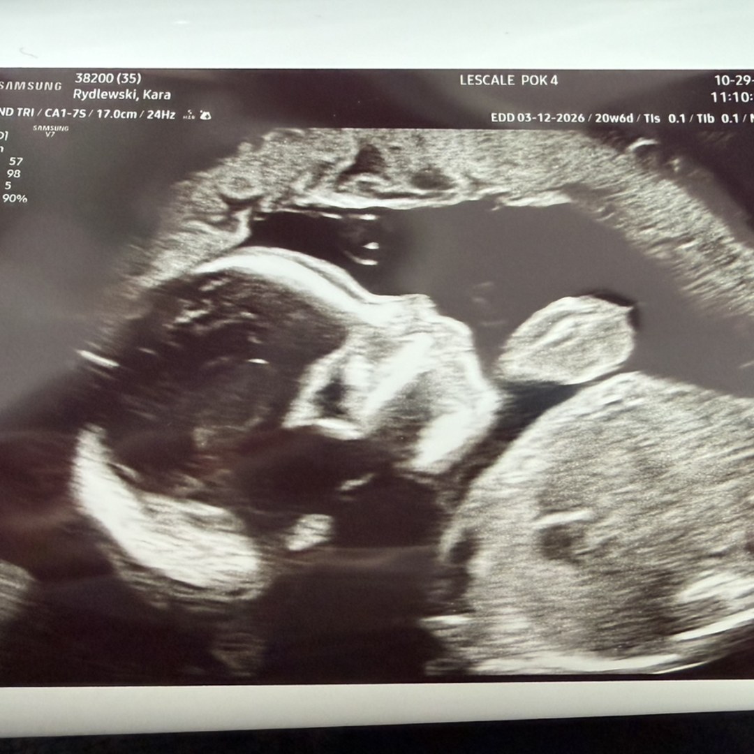 Photo shared by Kara for their Babylist baby registry.