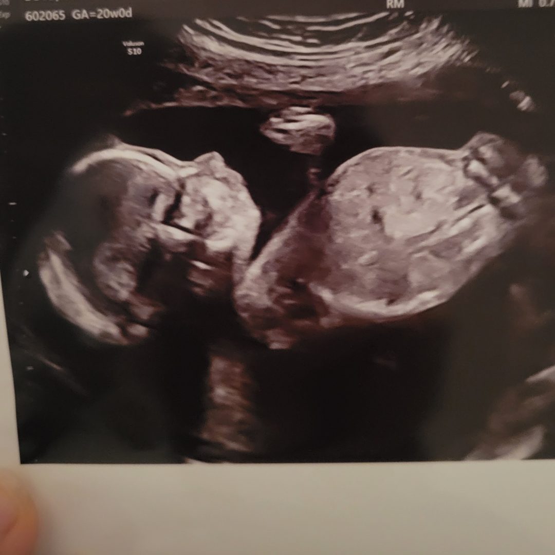 Photo shared by Savannah & Darren for their Babylist baby registry.