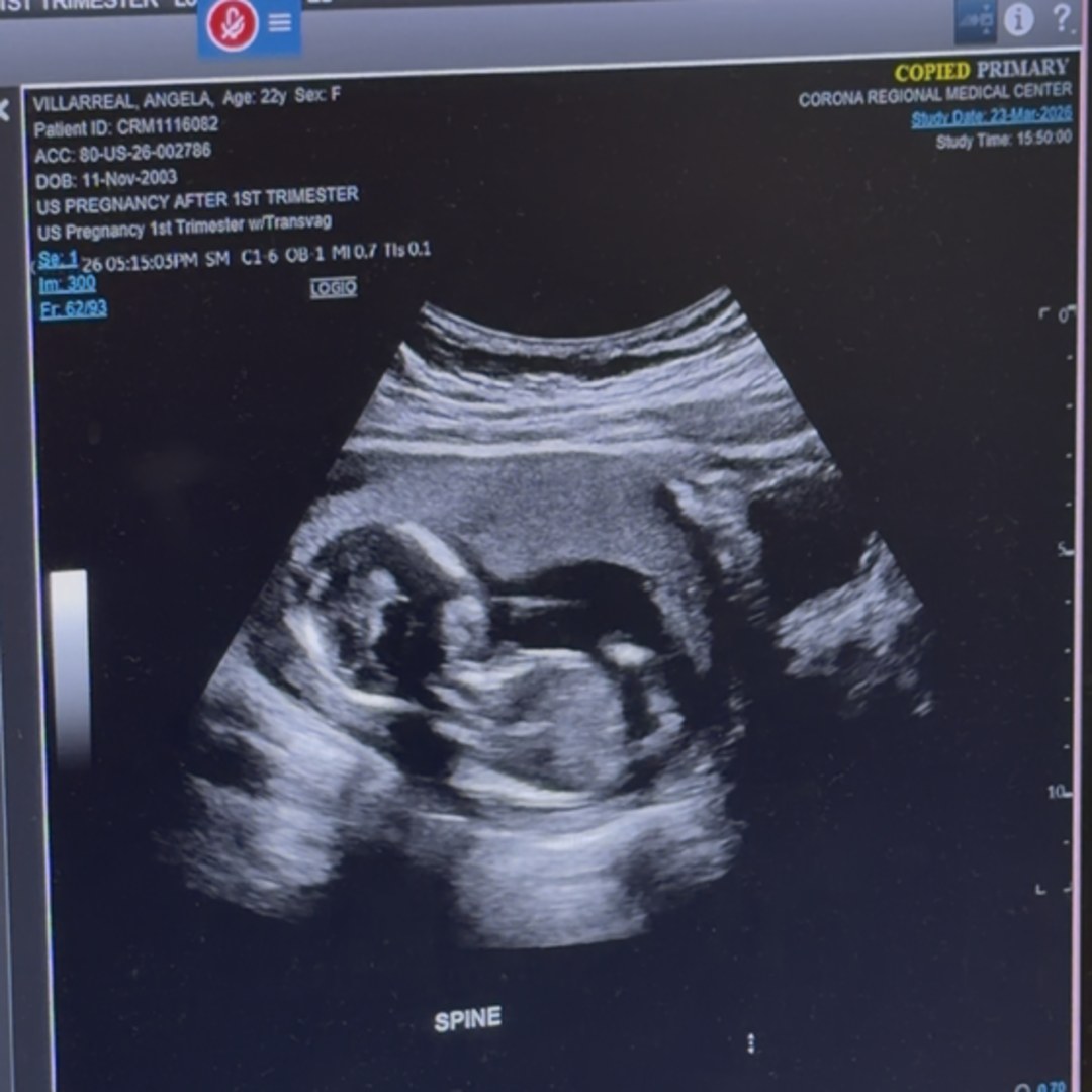 Photo shared by Angela for their Babylist baby registry.