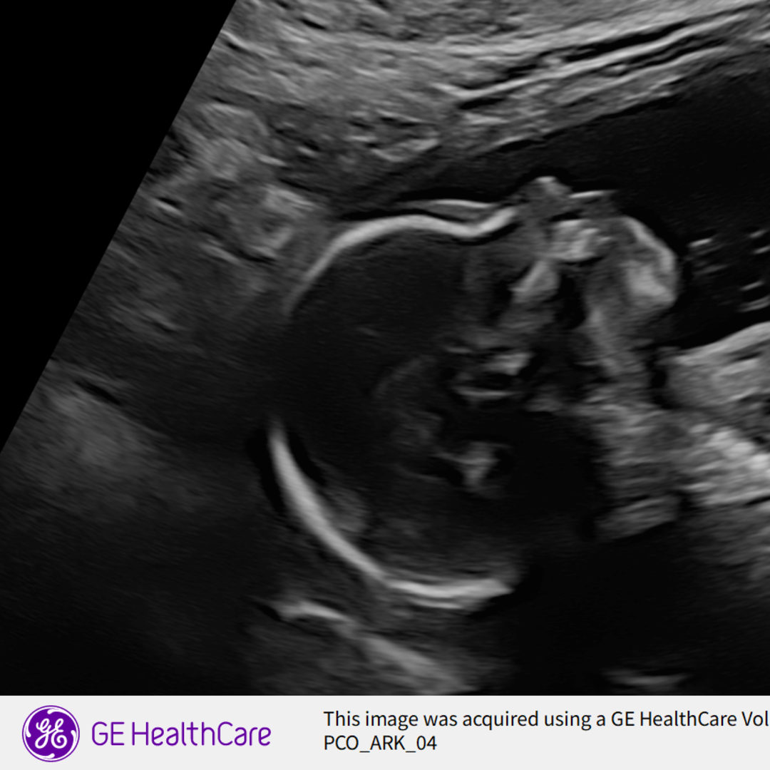 Photo shared by Hannan for their Babylist baby registry.