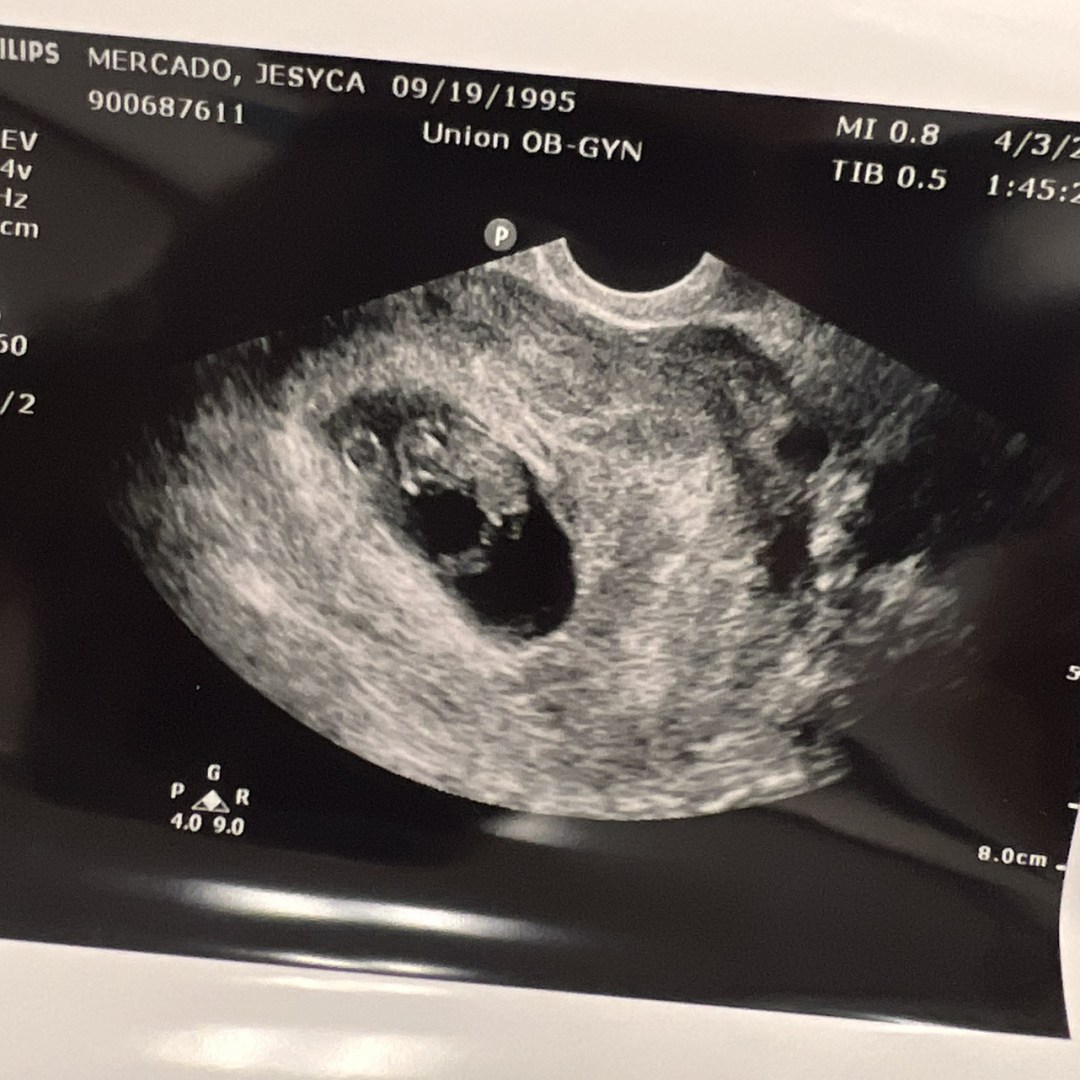 Photo shared by Jesyca for their Babylist baby registry.