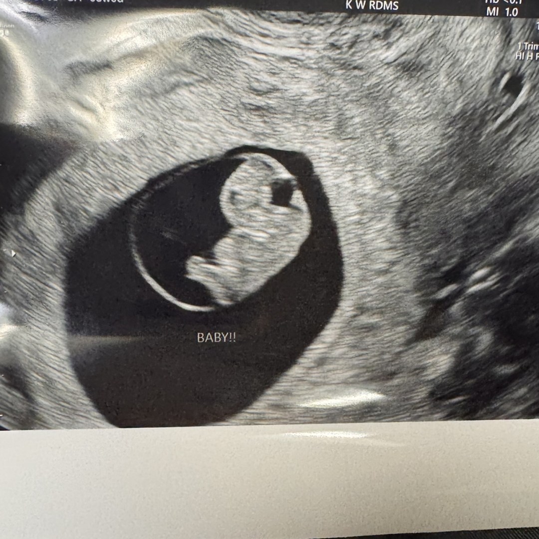 Photo shared by Alli for their Babylist baby registry.