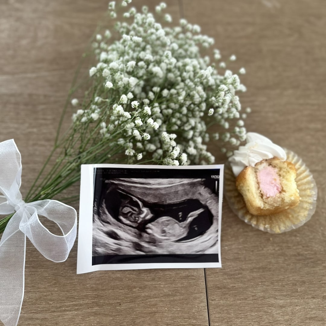 Photo shared by Anthony for their Babylist baby registry.