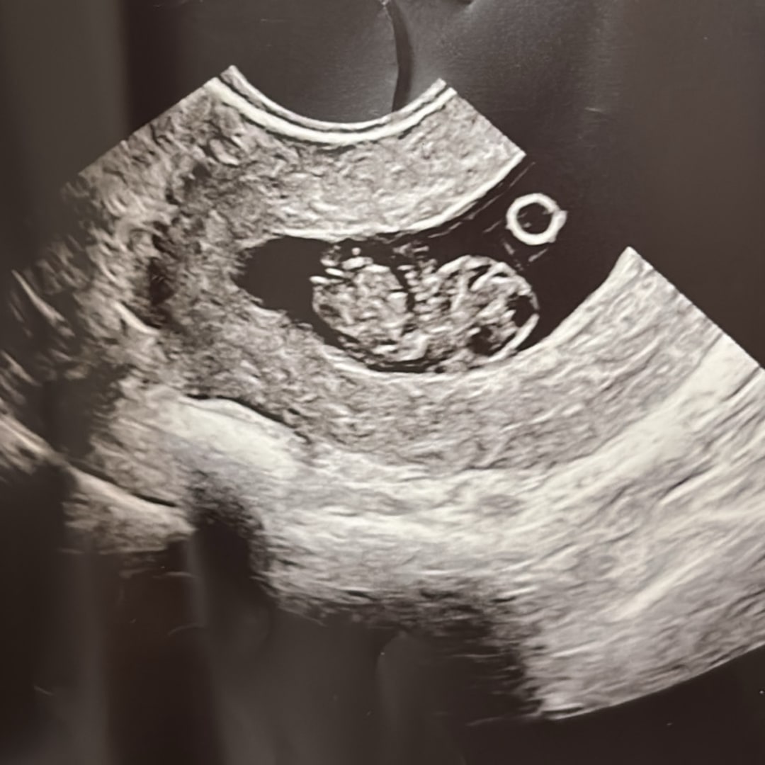 Photo shared by Kimeiko for their Babylist baby registry.