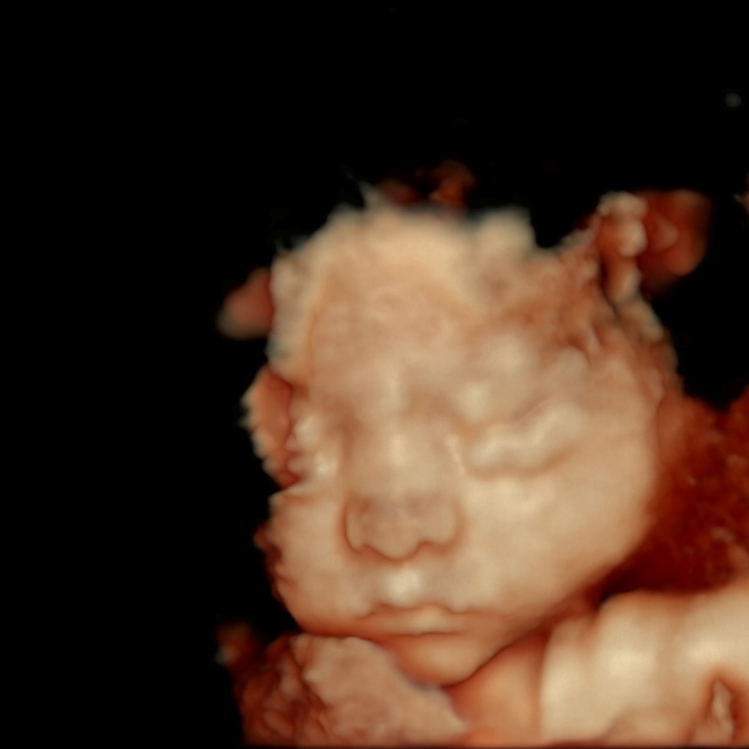 Photo shared by Catherine for their Babylist baby registry.