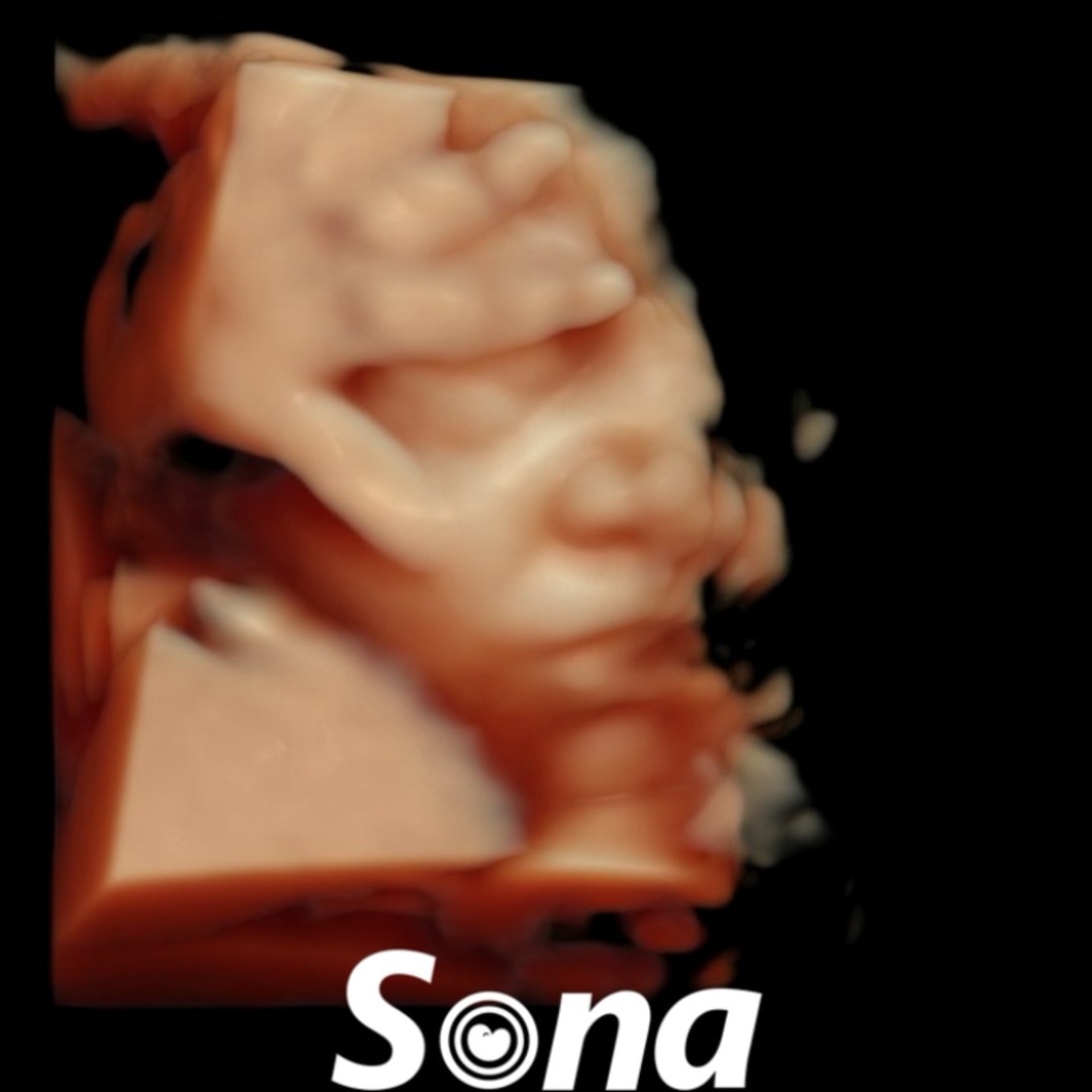 Photo shared by Destiny for their Babylist baby registry.