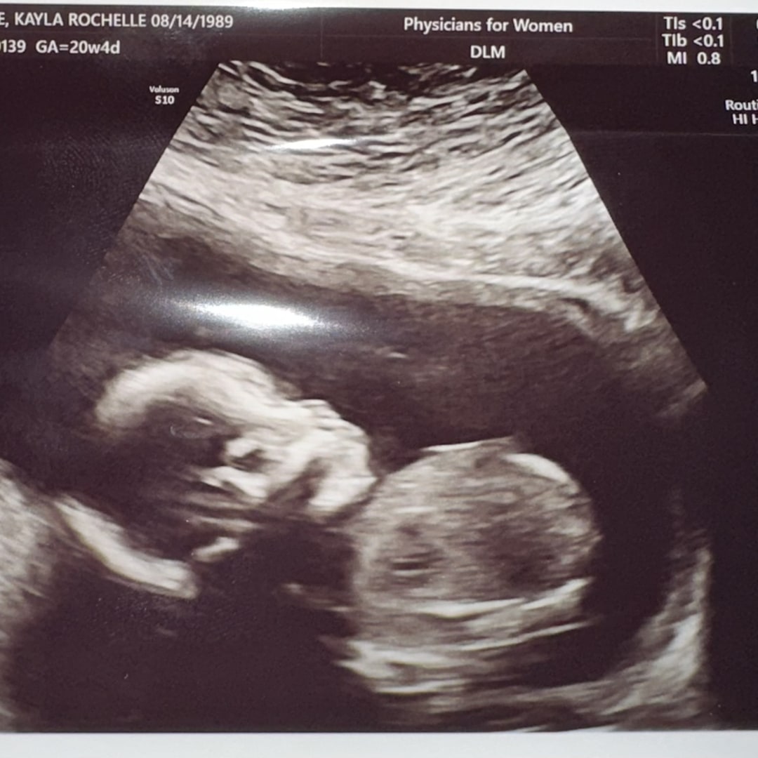 Photo shared by Kayla for their Babylist baby registry.
