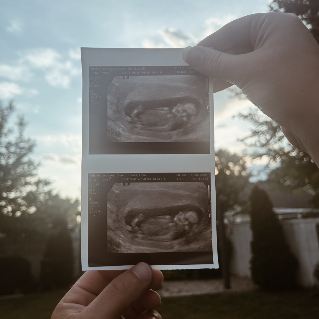 Photo shared by Grace for their Babylist baby registry.