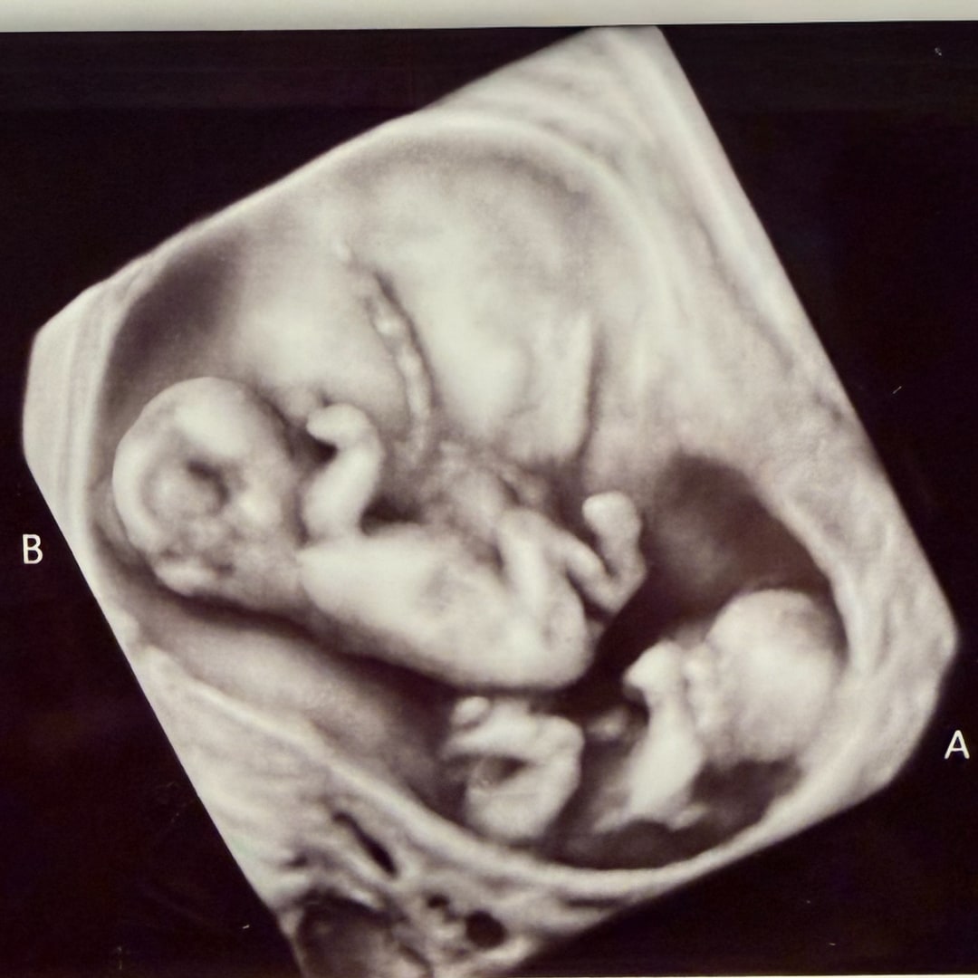 Photo shared by Mary for their Babylist baby registry.