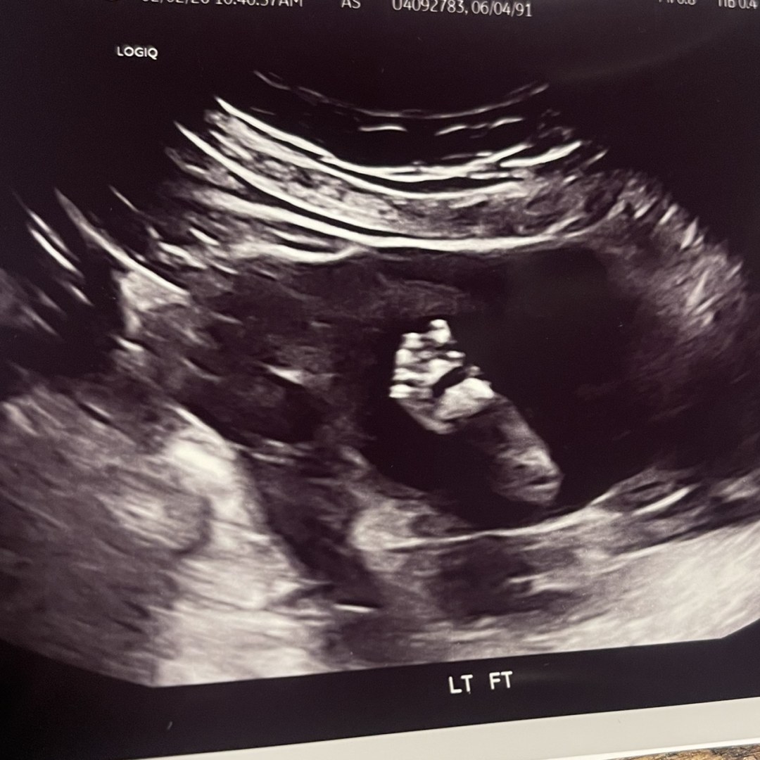 Photo shared by Kayla for their Babylist baby registry.