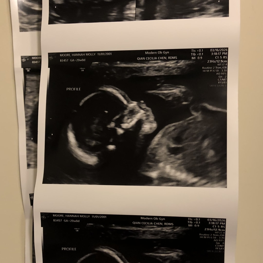 Photo shared by Molly for their Babylist baby registry.