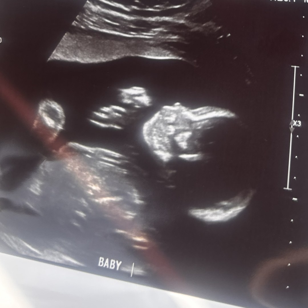 Photo shared by Raquel for their Babylist baby registry.