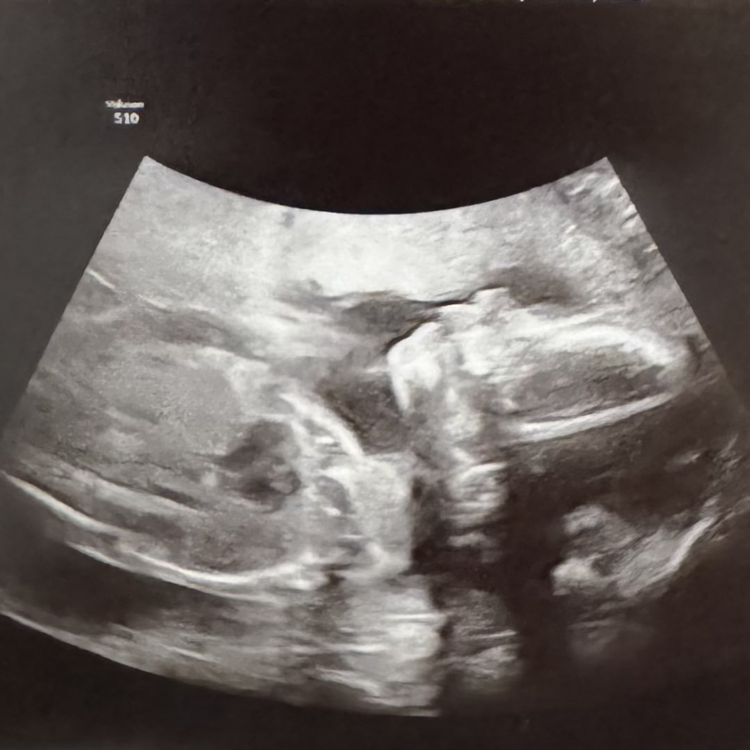 Photo shared by Kaitlyn for their Babylist baby registry.